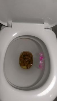 Plops in my toilet 00003