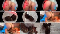 Fisheye2view.ScrinList