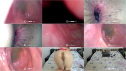 endoscope in my ass 2025-02-15 07_26.ScrinList endoscope in my ass 2025-02-15 07_26.ScrinList